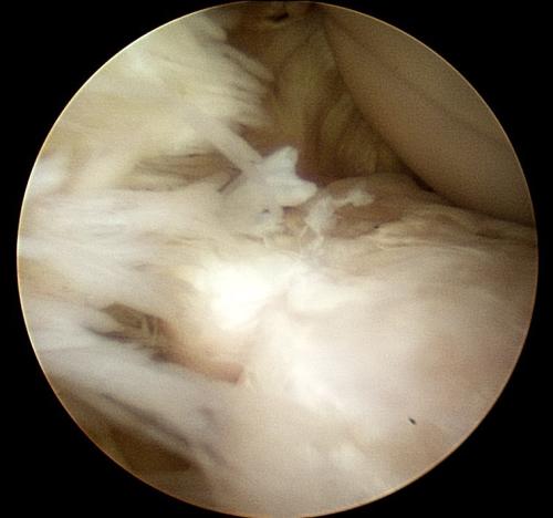 carpal-arthroscopy-of-a-racehorse