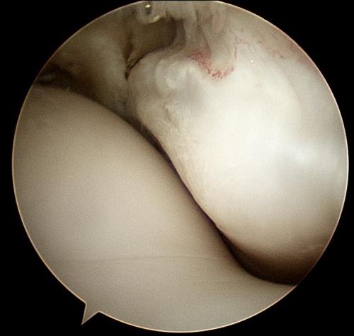 fetlock-arthroscopy